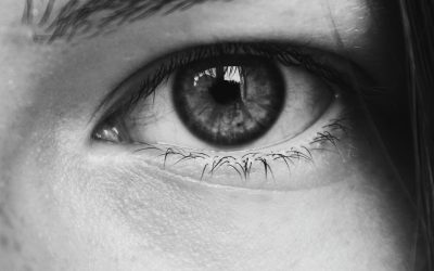 4 Things To Know About Corneal Arcus