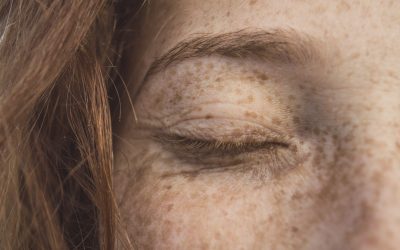 When Should You Get an Eyelid Lift?